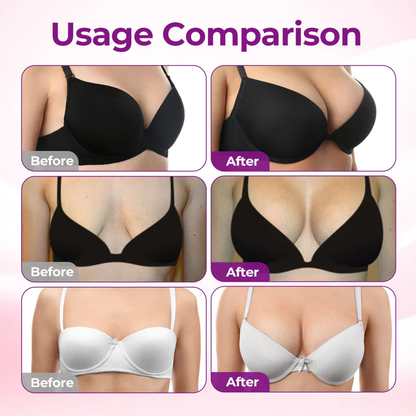 💥Nuravii® 💥Targeted Breast Enhancement Advanced Nano Microneedle Patch
